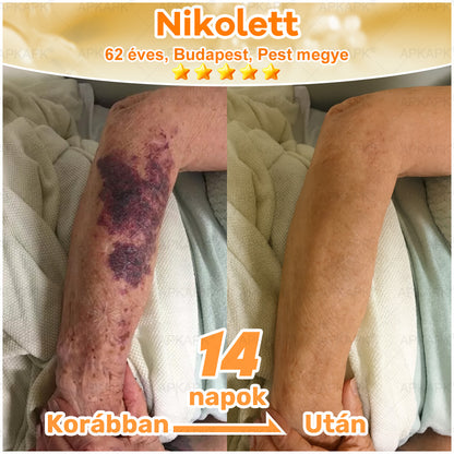 ⭐APKAPK®  Méhméreg krém a bőr megújítására 🐝 segít megoldani olyan bőrproblémákat, mint: ráncok, hegek, pigmentfoltok, striák, akné, pikkelysömör, ekcéma, bőrelváltozások, irritációk, gyulladások és egyéb bőrpanaszok.