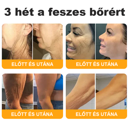 HAJUEI® Botox Méhméreg Ránctalanító Krém 🐝