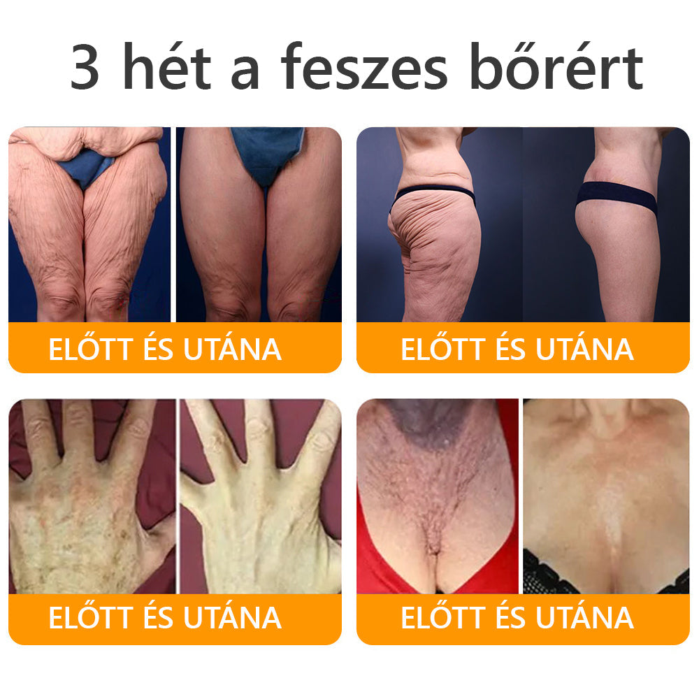 HAJUEI® Botox Méhméreg Ránctalanító Krém 🐝