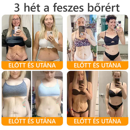 HAJUEI® Botox Méhméreg Ránctalanító Krém 🐝