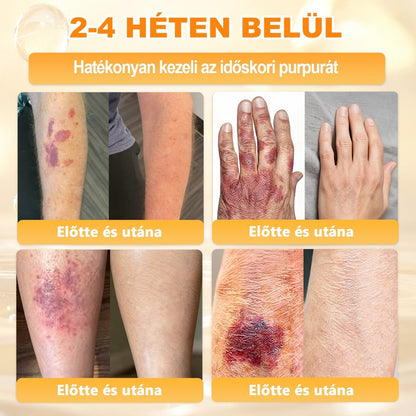 ⭐APKAPK®  Méhméreg krém a bőr megújítására 🐝 segít megoldani olyan bőrproblémákat, mint: ráncok, hegek, pigmentfoltok, striák, akné, pikkelysömör, ekcéma, bőrelváltozások, irritációk, gyulladások és egyéb bőrpanaszok.