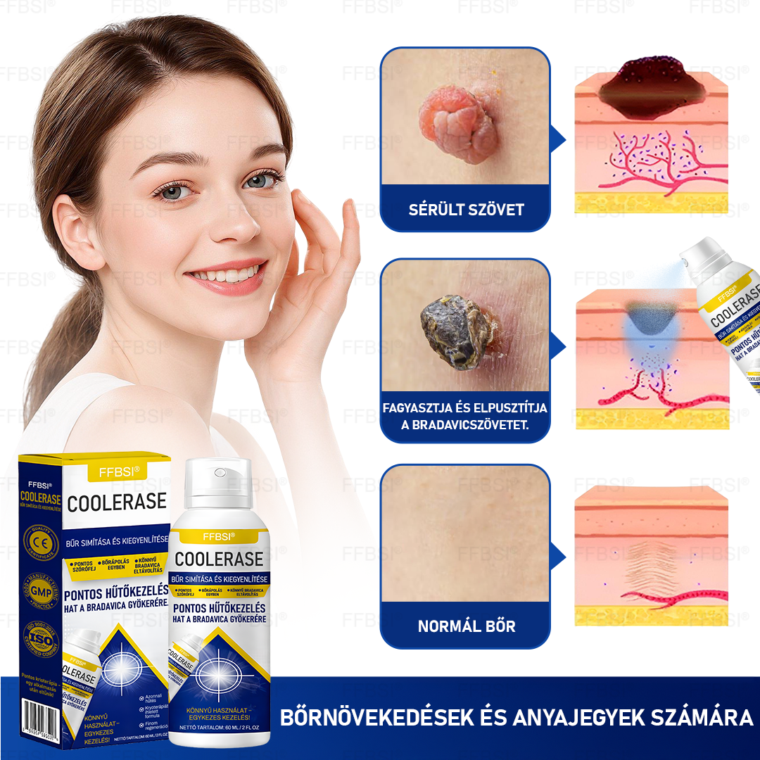 FFBSI® 🧊CoolErase Bőrregeneráló Spray (Szemölcsök, Hólyagok, Ekcéma, Pikkelysömör, Bőrkinövések, Akne, Bőrcímkék, Hegek, Anyajegyek)