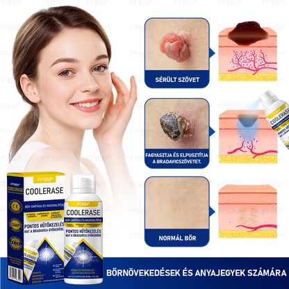 FFBSI® 🧊CoolErase Bőrregeneráló Spray (Szemölcsök, Hólyagok, Ekcéma, Pikkelysömör, Bőrkinövések, Akne, Bőrcímkék, Hegek, Anyajegyek)