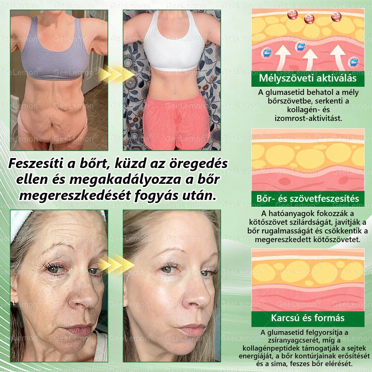 Magyar hivatalos bol 🍃 𝐆𝐞𝐞𝐋𝐞𝐦𝐨𝐧® 8 az 1-ben karcsúsító nano mikrotűs tapasz 🇭🇺 Napi egyszeri használat ✅ 7 napon belül látható eredmény – Alkalmas elhízás, szív- és érrendszeri problémák, cukorbetegség és ízületi problémák kezelésére
