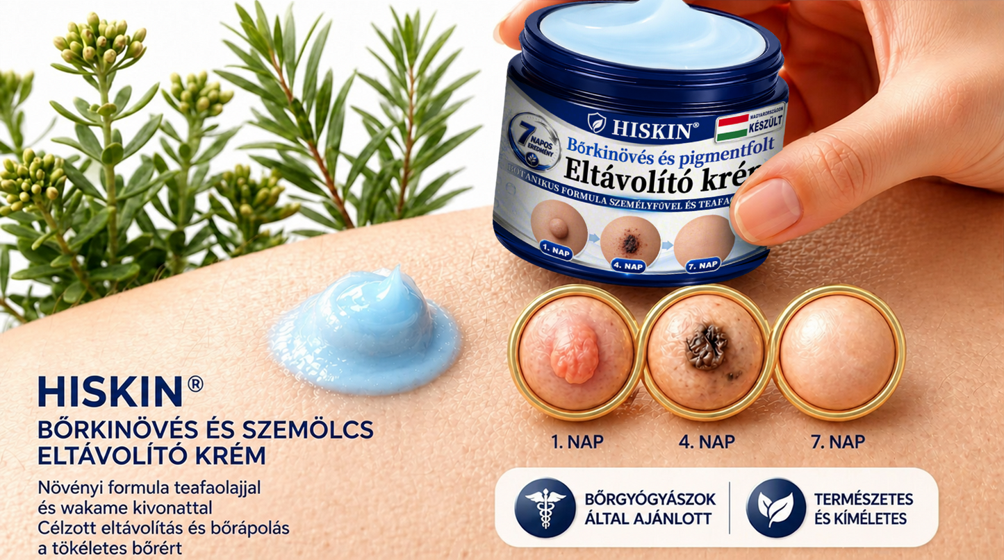 𝐇𝐈𝐒𝐊𝐈𝐍® 𝟕 𝐧𝐚𝐩𝐨𝐬 𝐤𝐫é𝐦 𝐛ő𝐫𝐤𝐢𝐧ö𝐯é𝐬𝐞𝐤 𝐞́𝐬 𝐩𝐢𝐠𝐦𝐞𝐧𝐭𝐟𝐨𝐥𝐭𝐨𝐤 𝐞𝐥𝐥𝐞𝐧 (𝐅á𝐣𝐝𝐚𝐥𝐨𝐦𝐦𝐞𝐧𝐭𝐞𝐬 𝐟𝐨𝐫𝐦𝐮𝐥𝐚 – 𝐇𝐞𝐠𝐦𝐞𝐧𝐭𝐞𝐬)
