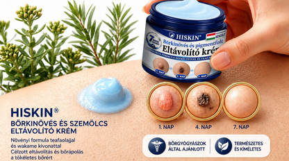 𝐇𝐈𝐒𝐊𝐈𝐍® 𝟕 𝐧𝐚𝐩𝐨𝐬 𝐤𝐫é𝐦 𝐛ő𝐫𝐤𝐢𝐧ö𝐯é𝐬𝐞𝐤 𝐞́𝐬 𝐩𝐢𝐠𝐦𝐞𝐧𝐭𝐟𝐨𝐥𝐭𝐨𝐤 𝐞𝐥𝐥𝐞𝐧 (𝐅á𝐣𝐝𝐚𝐥𝐨𝐦𝐦𝐞𝐧𝐭𝐞𝐬 𝐟𝐨𝐫𝐦𝐮𝐥𝐚 – 𝐇𝐞𝐠𝐦𝐞𝐧𝐭𝐞𝐬)