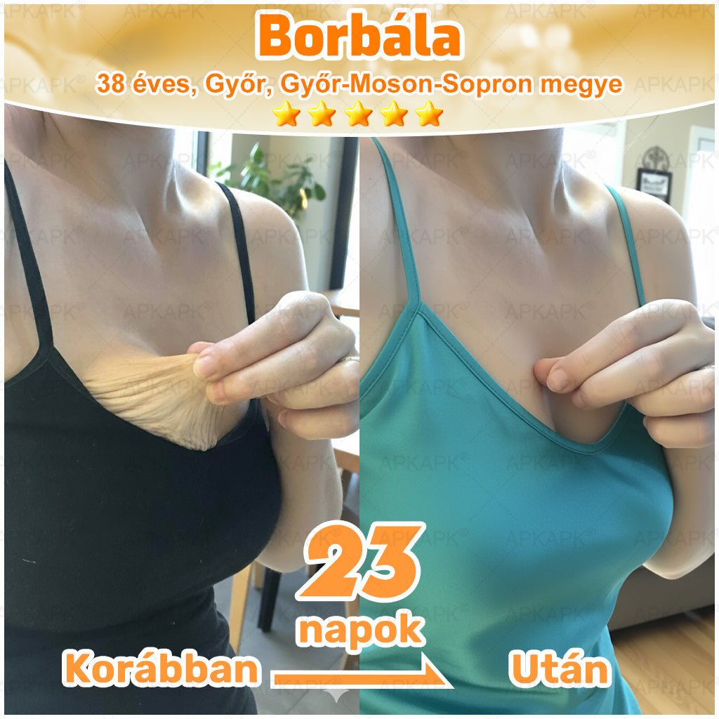 ⭐APKAPK®  Méhméreg krém a bőr megújítására 🐝 segít megoldani olyan bőrproblémákat, mint: ráncok, hegek, pigmentfoltok, striák, akné, pikkelysömör, ekcéma, bőrelváltozások, irritációk, gyulladások és egyéb bőrpanaszok.