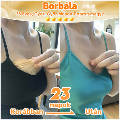 ⭐APKAPK®  Méhméreg krém a bőr megújítására 🐝 segít megoldani olyan bőrproblémákat, mint: ráncok, hegek, pigmentfoltok, striák, akné, pikkelysömör, ekcéma, bőrelváltozások, irritációk, gyulladások és egyéb bőrpanaszok.