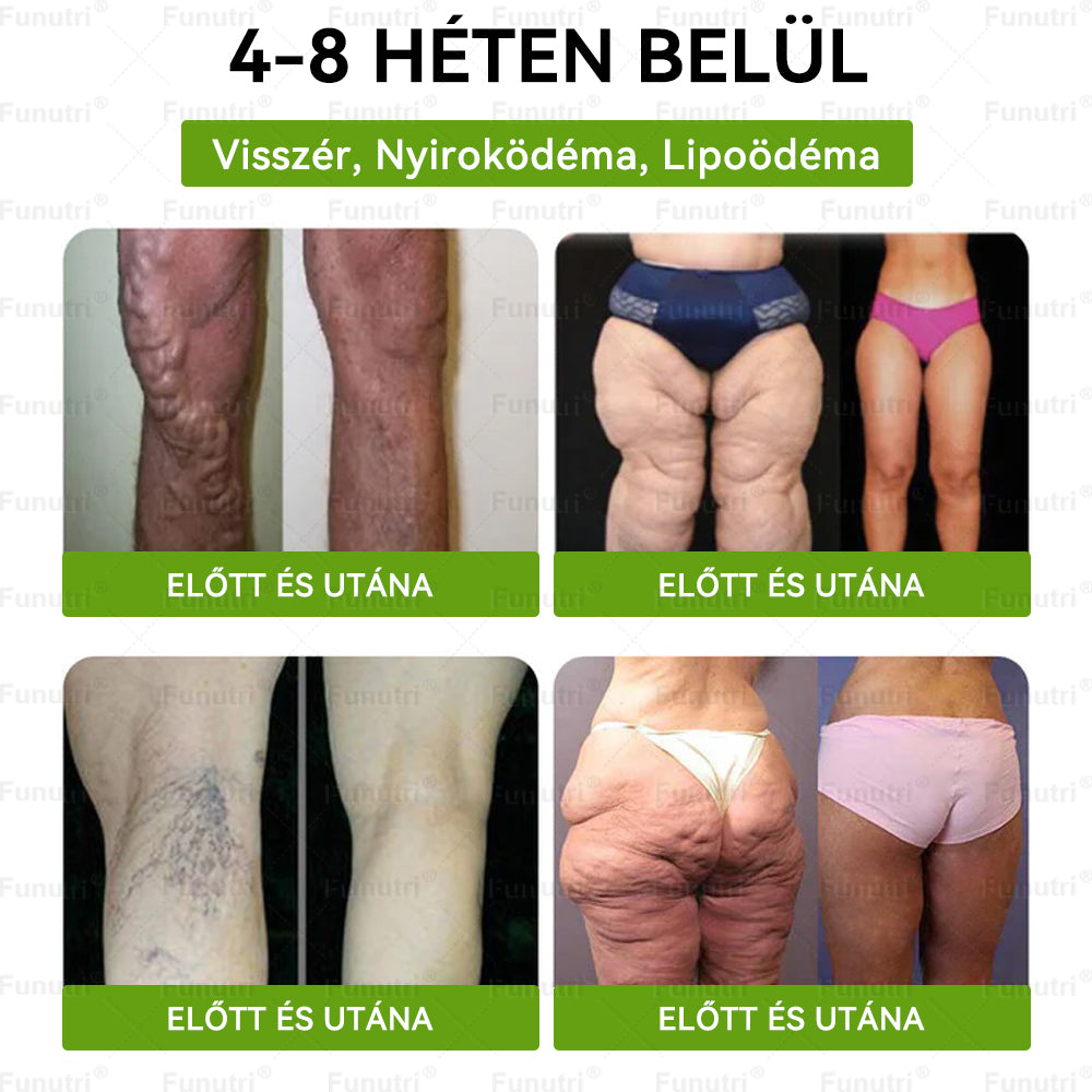Magyar szakértők által ajánlott · Hivatalos Bolt 👩‍⚕️ Funutri® 10 az 1-ben anyagcsere-támogató karcsúsító nano mikro-tűs tapasz