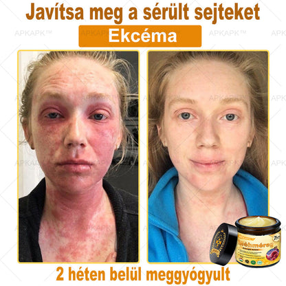 ⭐APKAPK®  Méhméreg krém a bőr megújítására 🐝 segít megoldani olyan bőrproblémákat, mint: ráncok, hegek, pigmentfoltok, striák, akné, pikkelysömör, ekcéma, bőrelváltozások, irritációk, gyulladások és egyéb bőrpanaszok.