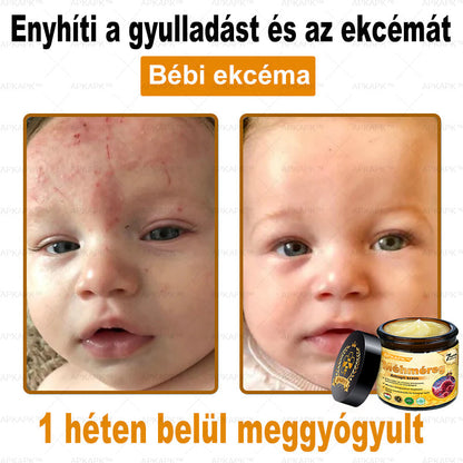 ⭐APKAPK®  Méhméreg krém a bőr megújítására 🐝 segít megoldani olyan bőrproblémákat, mint: ráncok, hegek, pigmentfoltok, striák, akné, pikkelysömör, ekcéma, bőrelváltozások, irritációk, gyulladások és egyéb bőrpanaszok.