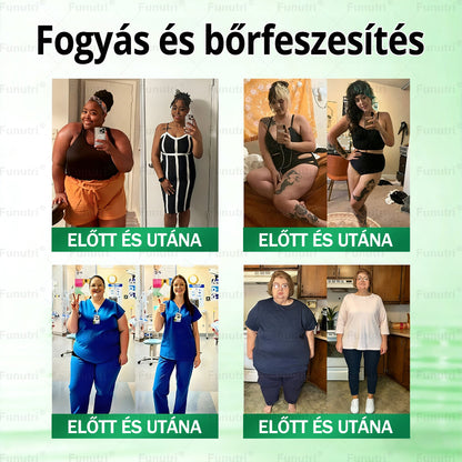 Magyar szakértők által ajánlott · Hivatalos Bolt 👩‍⚕️ Funutri® 10 az 1-ben anyagcsere-támogató karcsúsító nano mikro-tűs tapasz