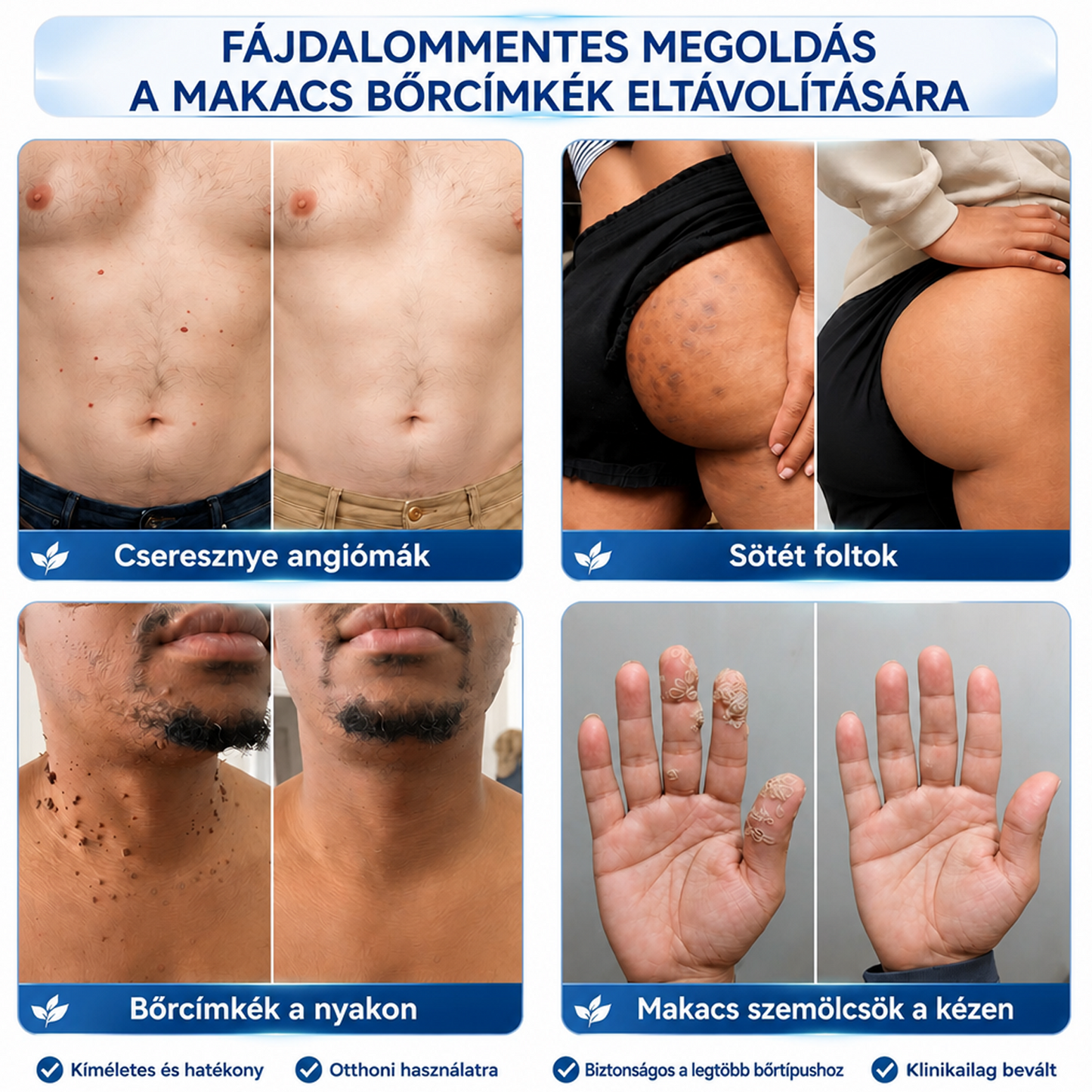 𝐇𝐈𝐒𝐊𝐈𝐍® 𝟕 𝐧𝐚𝐩𝐨𝐬 𝐤𝐫é𝐦 𝐛ő𝐫𝐤𝐢𝐧ö𝐯é𝐬𝐞𝐤 𝐞́𝐬 𝐩𝐢𝐠𝐦𝐞𝐧𝐭𝐟𝐨𝐥𝐭𝐨𝐤 𝐞𝐥𝐥𝐞𝐧 (𝐅á𝐣𝐝𝐚𝐥𝐨𝐦𝐦𝐞𝐧𝐭𝐞𝐬 𝐟𝐨𝐫𝐦𝐮𝐥𝐚 – 𝐇𝐞𝐠𝐦𝐞𝐧𝐭𝐞𝐬)
