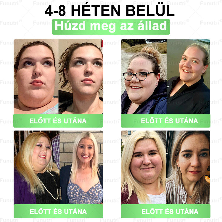 Magyar szakértők által ajánlott · Hivatalos Bolt 👩‍⚕️ Funutri® 10 az 1-ben anyagcsere-támogató karcsúsító nano mikro-tűs tapasz