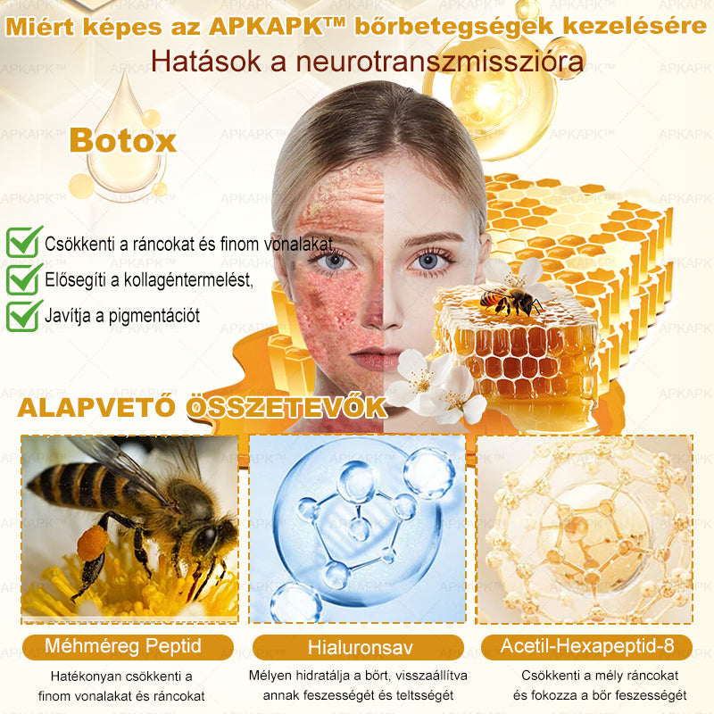 ⭐APKAPK®  Méhméreg krém a bőr megújítására 🐝 segít megoldani olyan bőrproblémákat, mint: ráncok, hegek, pigmentfoltok, striák, akné, pikkelysömör, ekcéma, bőrelváltozások, irritációk, gyulladások és egyéb bőrpanaszok.