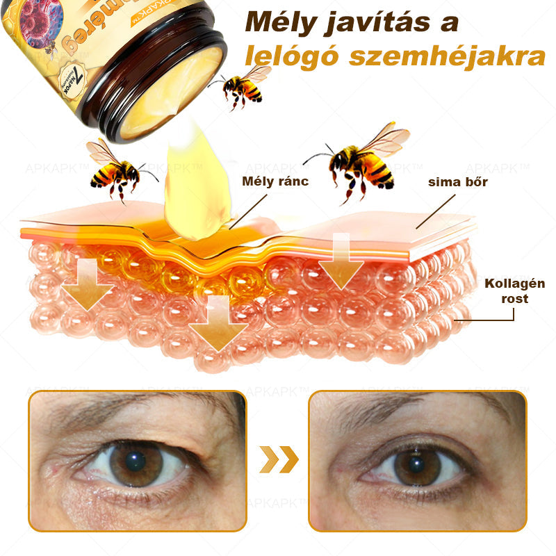 ⭐APKAPK®  Méhméreg krém a bőr megújítására 🐝 segít megoldani olyan bőrproblémákat, mint: ráncok, hegek, pigmentfoltok, striák, akné, pikkelysömör, ekcéma, bőrelváltozások, irritációk, gyulladások és egyéb bőrpanaszok.