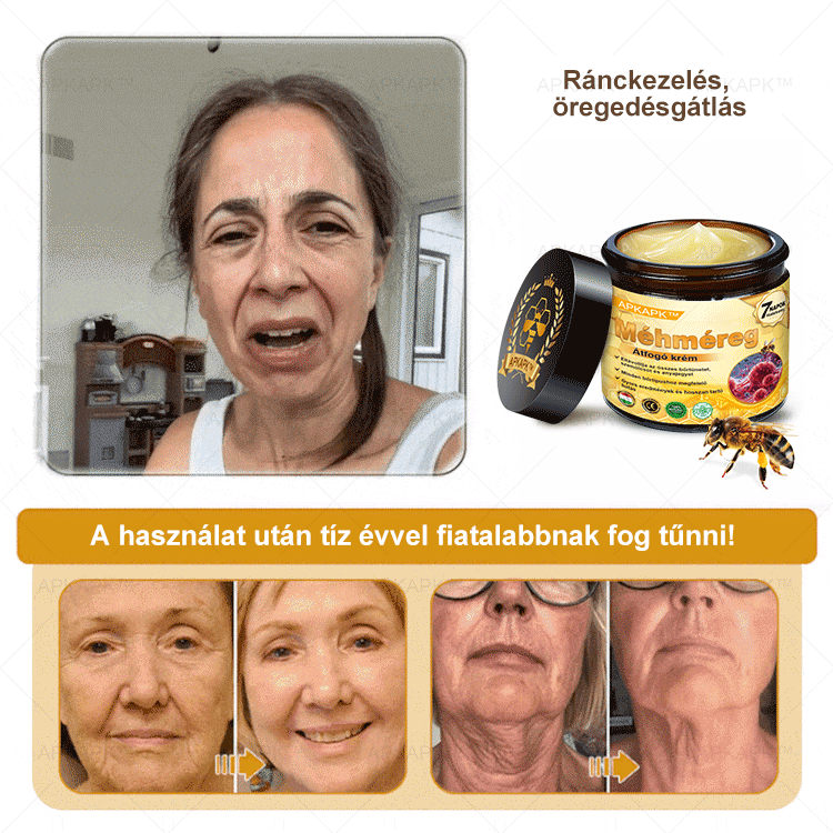 ⭐APKAPK®  Méhméreg krém a bőr megújítására 🐝 segít megoldani olyan bőrproblémákat, mint: ráncok, hegek, pigmentfoltok, striák, akné, pikkelysömör, ekcéma, bőrelváltozások, irritációk, gyulladások és egyéb bőrpanaszok.