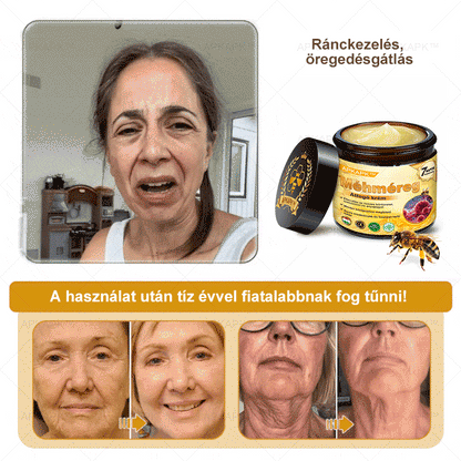 ⭐APKAPK®  Méhméreg krém a bőr megújítására 🐝 segít megoldani olyan bőrproblémákat, mint: ráncok, hegek, pigmentfoltok, striák, akné, pikkelysömör, ekcéma, bőrelváltozások, irritációk, gyulladások és egyéb bőrpanaszok.