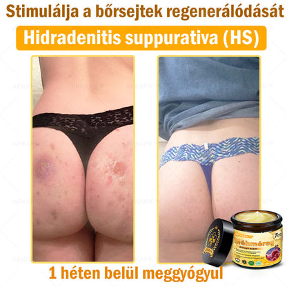 ⭐APKAPK®  Méhméreg krém a bőr megújítására 🐝 segít megoldani olyan bőrproblémákat, mint: ráncok, hegek, pigmentfoltok, striák, akné, pikkelysömör, ekcéma, bőrelváltozások, irritációk, gyulladások és egyéb bőrpanaszok.