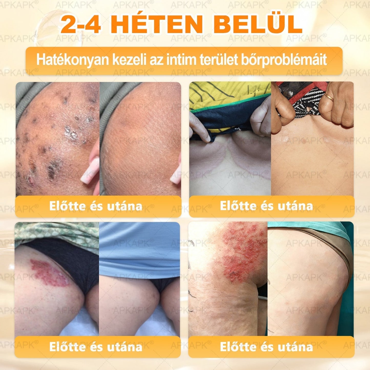 🎄Karácsonyi leárazás 🎄✨  ✨✨𝖠𝖯𝖪𝖠𝖯𝖪® méhméreges bőrmegújító krém