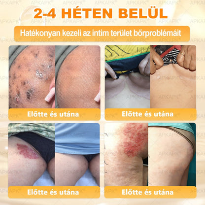 🎄Karácsonyi leárazás 🎄✨  ✨✨𝖠𝖯𝖪𝖠𝖯𝖪® méhméreges bőrmegújító krém