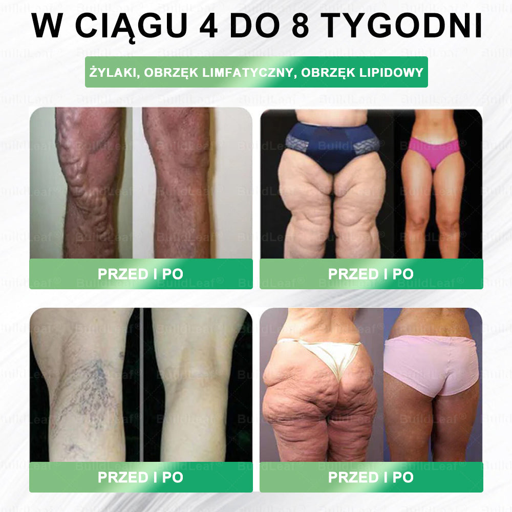 ✨ Oficjalny sklep Polska | ✨ BuildLeaf® GLP-1 8-w-1 Fit & Vital Solution (Jednorazowa dawka dziennie, widoczne efekty już po 7 dniach) ✅ Otyłość, zdrowie sercowo-naczyniowe, cukrzyca, bezdech senny, zdrowie jelit, problemy ze stawami i inne.
