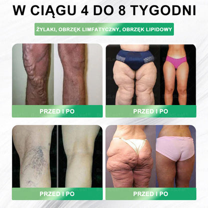 ✨ Oficjalny sklep Polska | ✨ BuildLeaf® GLP-1 8-w-1 Fit & Vital Solution (Jednorazowa dawka dziennie, widoczne efekty już po 7 dniach) ✅ Otyłość, zdrowie sercowo-naczyniowe, cukrzyca, bezdech senny, zdrowie jelit, problemy ze stawami i inne.