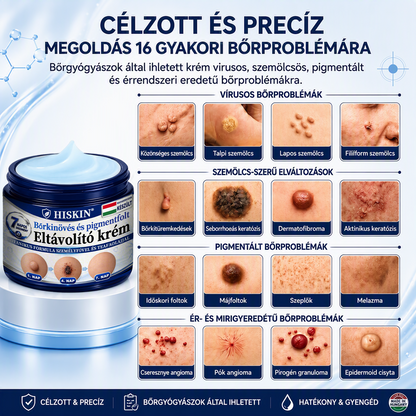 𝐇𝐈𝐒𝐊𝐈𝐍® 𝟕 𝐧𝐚𝐩𝐨𝐬 𝐤𝐫é𝐦 𝐛ő𝐫𝐤𝐢𝐧ö𝐯é𝐬𝐞𝐤 𝐞́𝐬 𝐩𝐢𝐠𝐦𝐞𝐧𝐭𝐟𝐨𝐥𝐭𝐨𝐤 𝐞𝐥𝐥𝐞𝐧 (𝐅á𝐣𝐝𝐚𝐥𝐨𝐦𝐦𝐞𝐧𝐭𝐞𝐬 𝐟𝐨𝐫𝐦𝐮𝐥𝐚 – 𝐇𝐞𝐠𝐦𝐞𝐧𝐭𝐞𝐬)