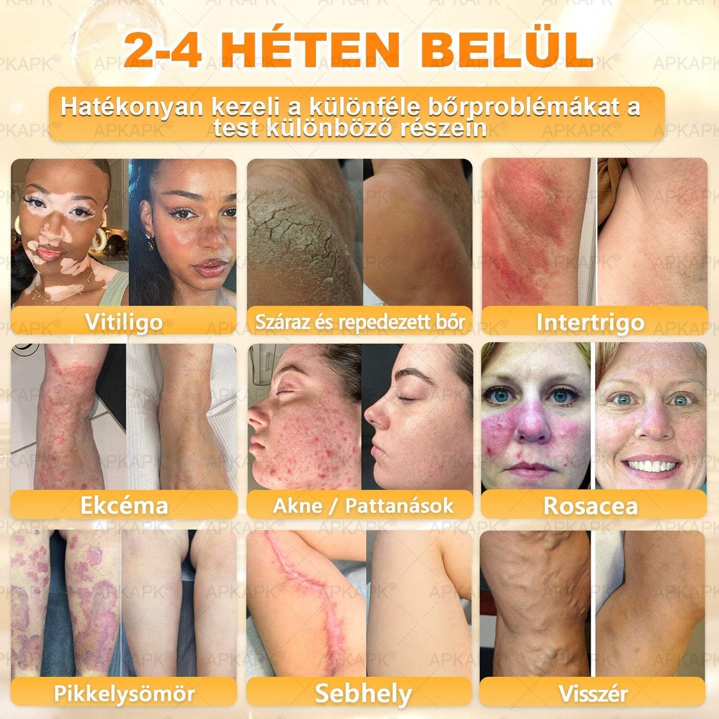 🎄Karácsonyi leárazás 🎄✨  ✨✨𝖠𝖯𝖪𝖠𝖯𝖪® méhméreges bőrmegújító krém