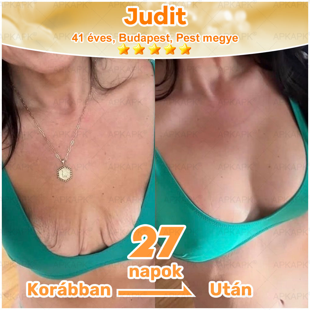 ⭐APKAPK®  Méhméreg krém a bőr megújítására 🐝 segít megoldani olyan bőrproblémákat, mint: ráncok, hegek, pigmentfoltok, striák, akné, pikkelysömör, ekcéma, bőrelváltozások, irritációk, gyulladások és egyéb bőrpanaszok.