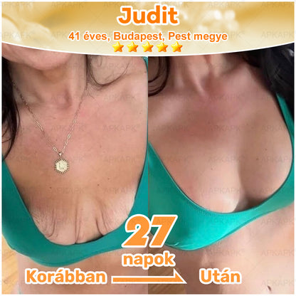 ⭐APKAPK®  Méhméreg krém a bőr megújítására 🐝 segít megoldani olyan bőrproblémákat, mint: ráncok, hegek, pigmentfoltok, striák, akné, pikkelysömör, ekcéma, bőrelváltozások, irritációk, gyulladások és egyéb bőrpanaszok.