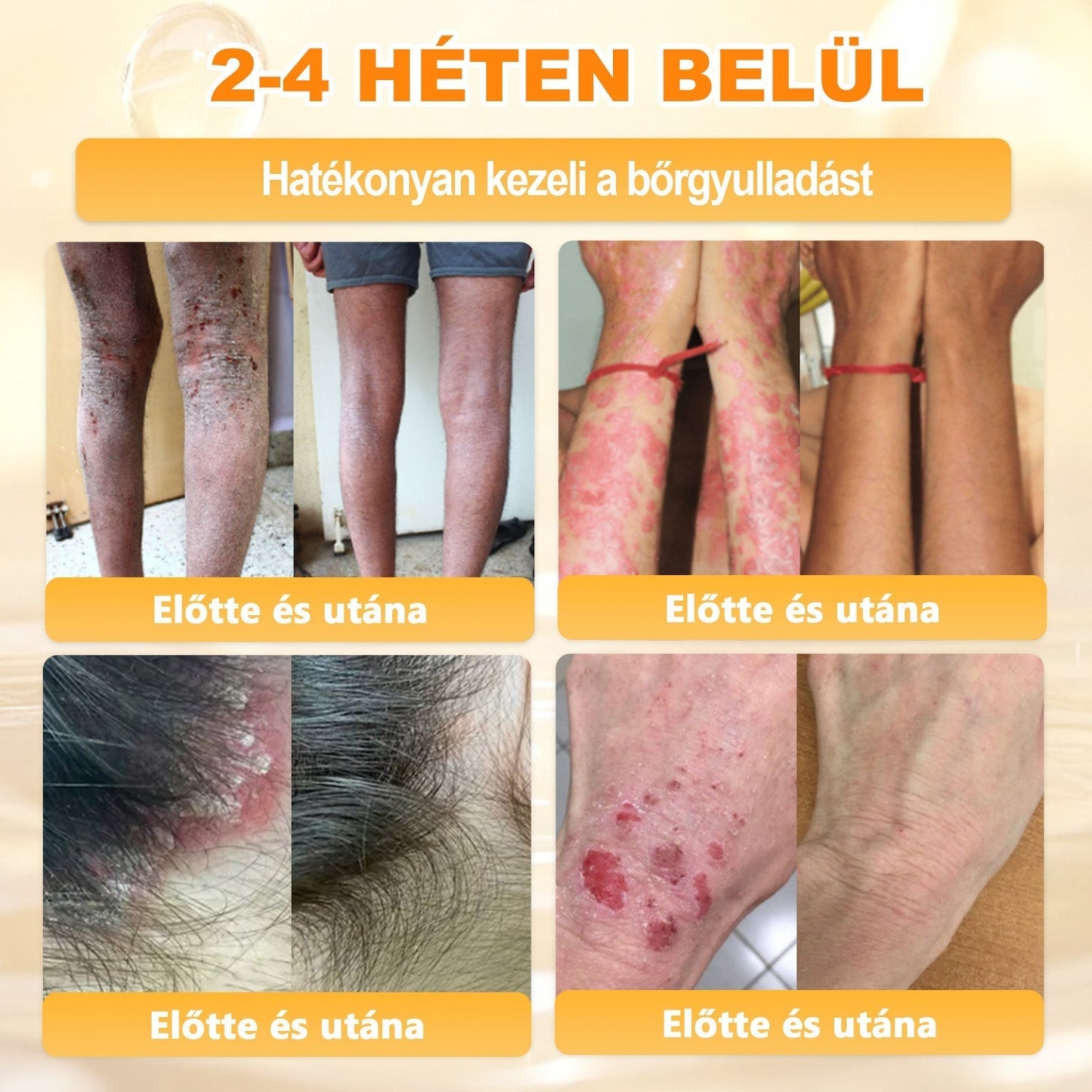 🎄Karácsonyi leárazás 🎄✨  ✨✨𝖠𝖯𝖪𝖠𝖯𝖪® méhméreges bőrmegújító krém