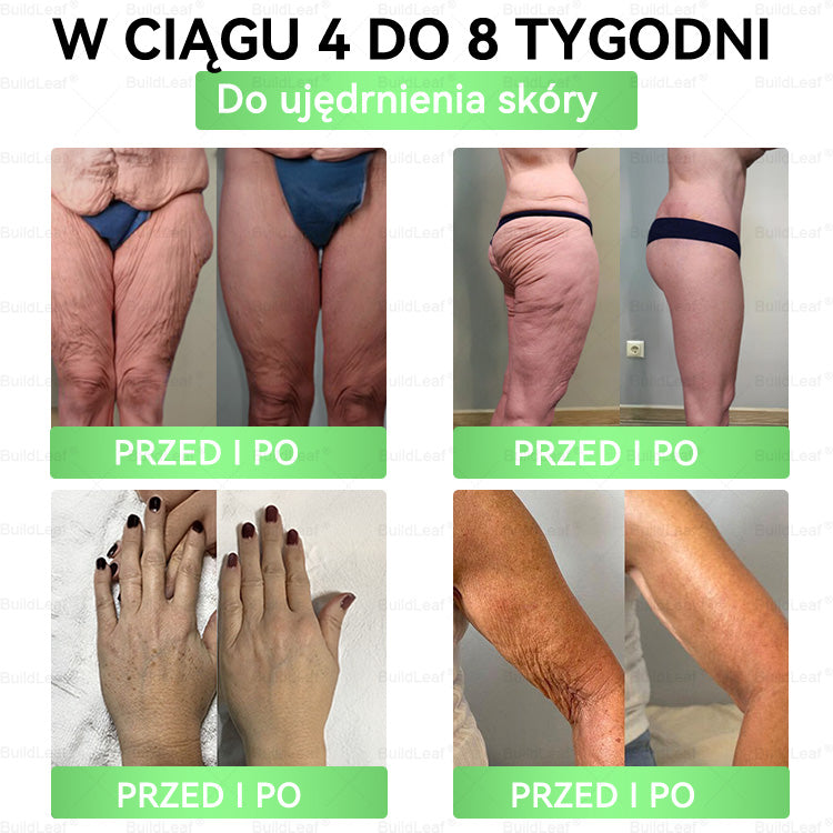 🖤🔥 Oficjalny sklep 👩‍⚕️ BuildLeaf® GLP-1 8-w-1 roztwór doustny (raz dziennie, efekty w 7 dni) Wspiera odchudzanie, serce, cukier, sen, jelita, stawy oraz ujędrnia skórę i dodaje energii