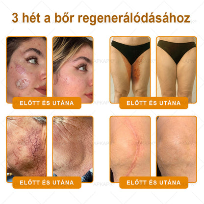 🎄Karácsonyi leárazás 🎄✨  ✨✨𝖠𝖯𝖪𝖠𝖯𝖪® méhméreges bőrmegújító krém