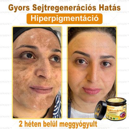 ⭐APKAPK®  Méhméreg krém a bőr megújítására 🐝 segít megoldani olyan bőrproblémákat, mint: ráncok, hegek, pigmentfoltok, striák, akné, pikkelysömör, ekcéma, bőrelváltozások, irritációk, gyulladások és egyéb bőrpanaszok.