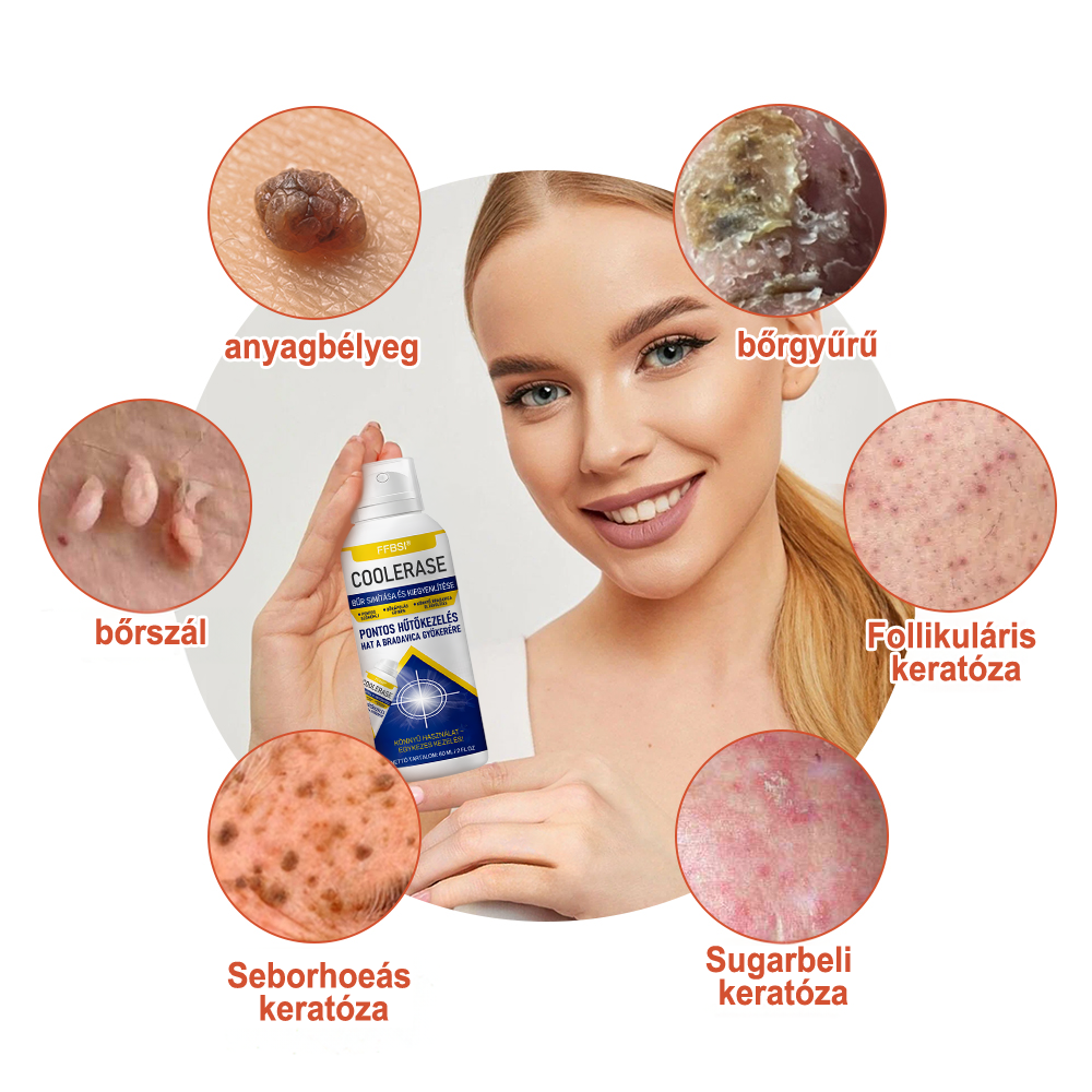FFBSI® 🧊CoolErase Bőrregeneráló Spray (Szemölcsök, Hólyagok, Ekcéma, Pikkelysömör, Bőrkinövések, Akne, Bőrcímkék, Hegek, Anyajegyek)