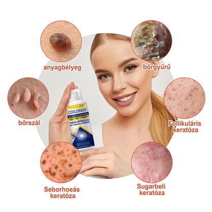 FFBSI® 🧊CoolErase Bőrregeneráló Spray (Szemölcsök, Hólyagok, Ekcéma, Pikkelysömör, Bőrkinövések, Akne, Bőrcímkék, Hegek, Anyajegyek)