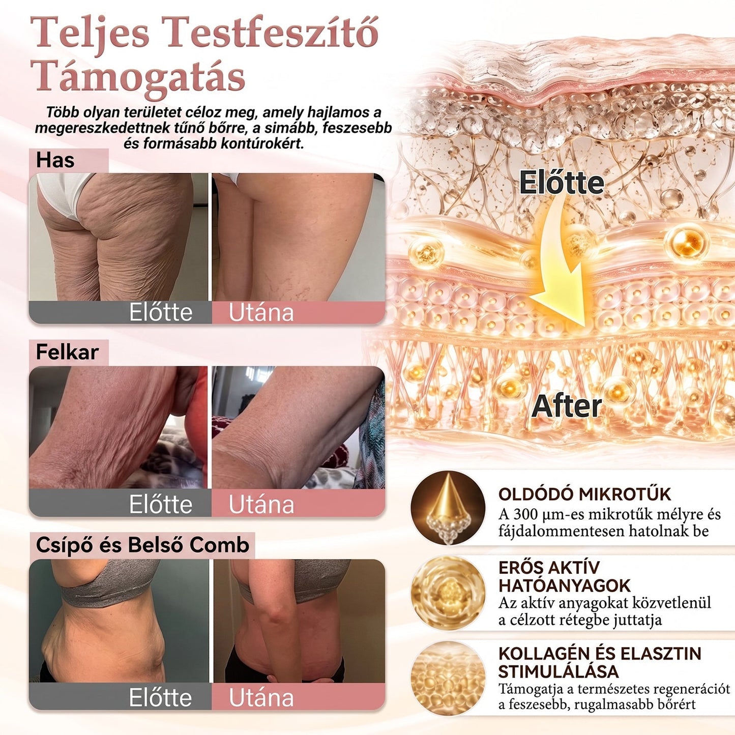 🥇A 𝐇𝐢𝐬𝐤𝐢𝐧® különleges meglepetéssel készült számodra! Már most is nagyszerű ajánlatot kaptál, de most egy még kedvezőbb lehetőséget oldottál fel: a következő vásárlásodra óriási, 50%-os kedvezményt kapsz — kizárólag a következő két percben!