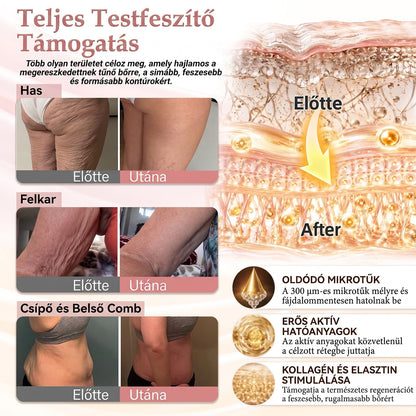 🥇A 𝐇𝐢𝐬𝐤𝐢𝐧® különleges meglepetéssel készült számodra! Már most is nagyszerű ajánlatot kaptál, de most egy még kedvezőbb lehetőséget oldottál fel: a következő vásárlásodra óriási, 50%-os kedvezményt kapsz — kizárólag a következő két percben!
