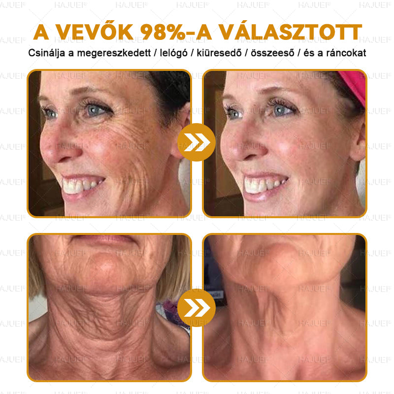 HAJUEI® Botox Méhméreg Ránctalanító Krém 🐝