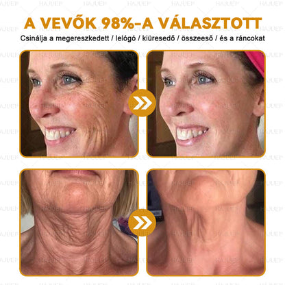 HAJUEI® Botox Méhméreg Ránctalanító Krém 🐝