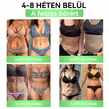 Magyar hivatalos bol 🍃 𝐆𝐞𝐞𝐋𝐞𝐦𝐨𝐧® 8 az 1-ben karcsúsító nano mikrotűs tapasz 🇭🇺 Napi egyszeri használat ✅ 7 napon belül látható eredmény – Alkalmas elhízás, szív- és érrendszeri problémák, cukorbetegség és ízületi problémák kezelésére